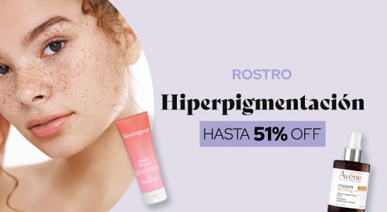 Hiperpigmentación