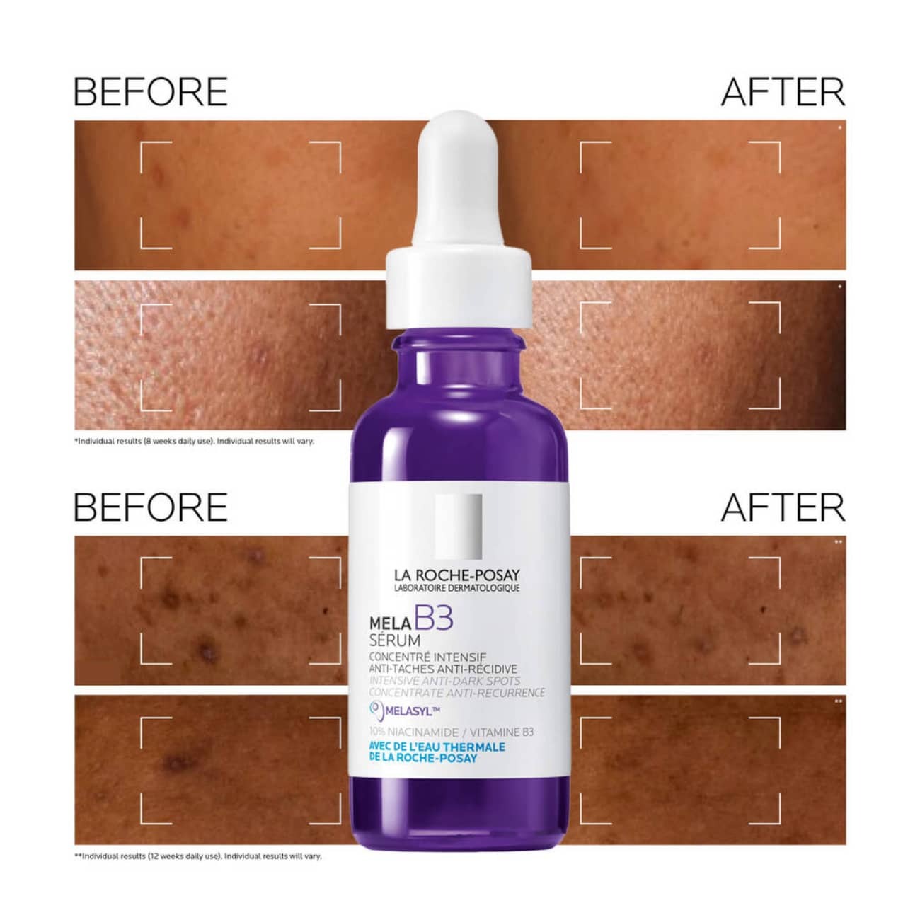 La Roche-Posay Mela B3 Serum 30ml